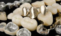 Dental Alloys Market 2025-2031 Is Set To Experience Revolutionary Growth