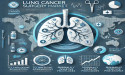 Global Lung Cancer Surgery Market to Reach USD 2.5 Billion by 2034 grow at a steady CAGR of 5.7% | FMI