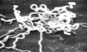Syphilis pathogen from the petri dish