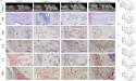  Unraveling the Mechanism Behind Orthodontic Tooth Movement 