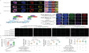  Unlocking a new path to AML treatment: targeting the JMJD1C-RUNX1 axis for leukemia progression control 