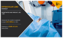Intraocular Lens Market: The Evolution and Advancements in Intraocular Lens (2025 Analysis)