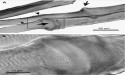 The Brookbush Institute Publishes NEW Course and Glossary Updates: 'Taut Band'