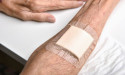 Regenerative Therapies for Burns, Wounds, and More Now Available From Stem Health Plus