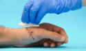 Introducing Professional Wound Care Solutions From Stem Health Plus