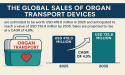 Global Organ Transport Devices Market Poised for Growth to Reach USD 735.8 Million by 2035 at a CAGR of 4.9% | FMI