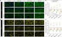 Revealing the key player in oral submucous fibrosis: could COMP be the solution?
