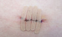 Stem Health Plus Provides Expert Care for Those Experiencing Post-Surgical Healing