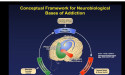 Neuroscience Based Medications Offer Hope in Addiction Crisis, Says NYC Doctor