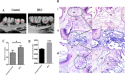 Space conditions can cause gum inflammation and bone loss, say scientists