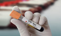 Call My Doctor Launches At-Home STD Testing Service in Dubai