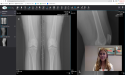  DataFirst Announces Strategic Partnership with TeleRay to Transform Virtual Care and Radiology Imaging Through AI 