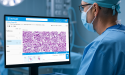 Study Validates Techcyte Fusion™ AI-Assisted Kidney Biopsy Evaluation to Improve Organ Allocation Efficiency