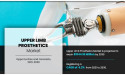 Upper Limb Prosthetics Market to Exceed $1 Billion by 2030 Driven by Tech & Accident Rates