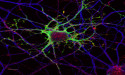 Finding the Hidden Link Between Diabetic Nerve Damage and Bone Loss