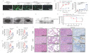 Fighting the SFTS virus with lipoxygenase: a new hope for treatment