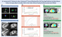  AI-Powered CT Chamber Volumetry Predicts Heart Failure Risk As Accurately As MRI, New Study Shows 