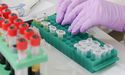 BD1 Bags Patent For ‘Regulation Of BARD1 Expression By Non-Coding RNA’; Stock Surges 17%