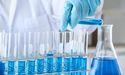 Is Celanese Suffering Amid Steady Downward Revisions?