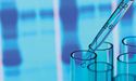 The Share Price Of Factor Therapeutics Remains Unaffected By The Retirement Of The Chief Executive Officer