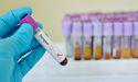 Invion (ASX:IVX) all set to tap the US$1.3bn dengue treatment market through Photosoft<sup>TM</sup> technology