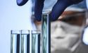  Pharmaxis’ Shares Uplifted On ASX As Its Inhibitor Program Is Ready To Enter Phase 2 Clinical Studies 