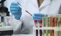 GSK Halts Further Trials for Herpes Vaccine Following Disappointing Phase II Results