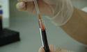 Chimeric Therapeutics (ASX:CHM) updates about fourth dose cohort in CHM 1101 study