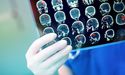 Telix’s Shares Uplifted On ASX After Completing First And Second Stage Consultation With PMDA