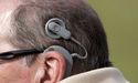 Cochlear Limited’s Shares Plunged On Unfavorable Outcome Of Ruling In USA Patent Infringement Case