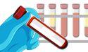  Sigma Healthcare (ASX:SIG) Delivers Higher Revenue and EBIT in FY25 