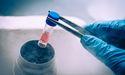 AstraZeneca Withdraws EU Application for Key Lung Cancer Drug Amid Trial Setbacks