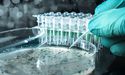 TBG Diagnostics Limited Inked A Deal With Zhangsha ZhangYe Medical- What You Need to Know